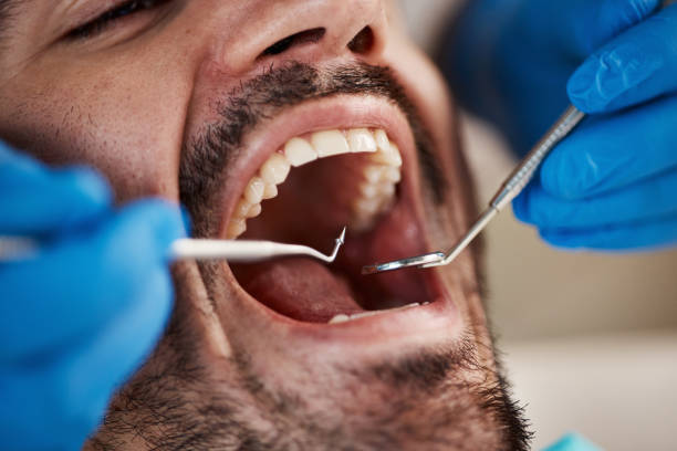Best Broken or Chipped Tooth Repair in Clay, AL