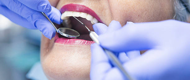 Best Walk-In Emergency Dental Services in Clay, AL